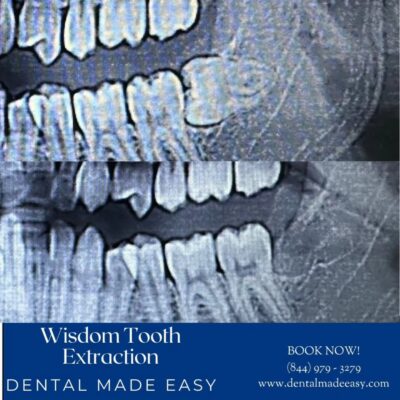 Dental Made Easy