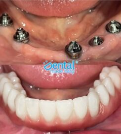 Dental Made Easy