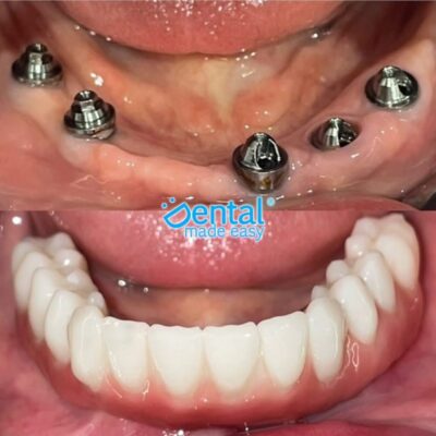 Dental Made Easy