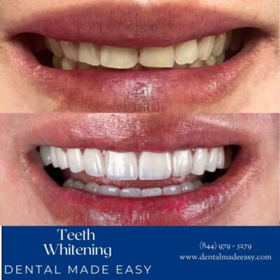 Dental Made Easy